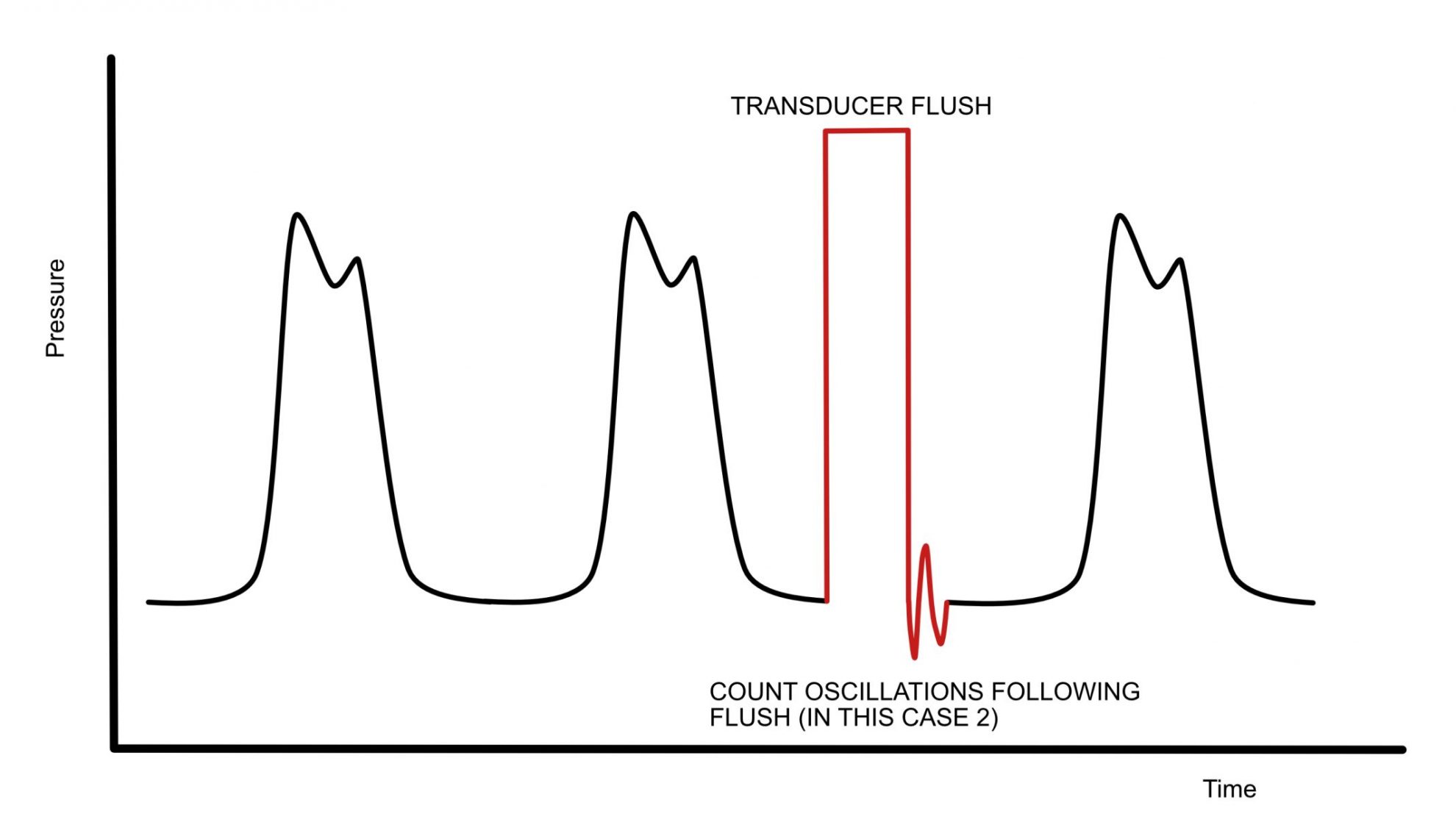Arterial Lines Intensive Care in a Flash